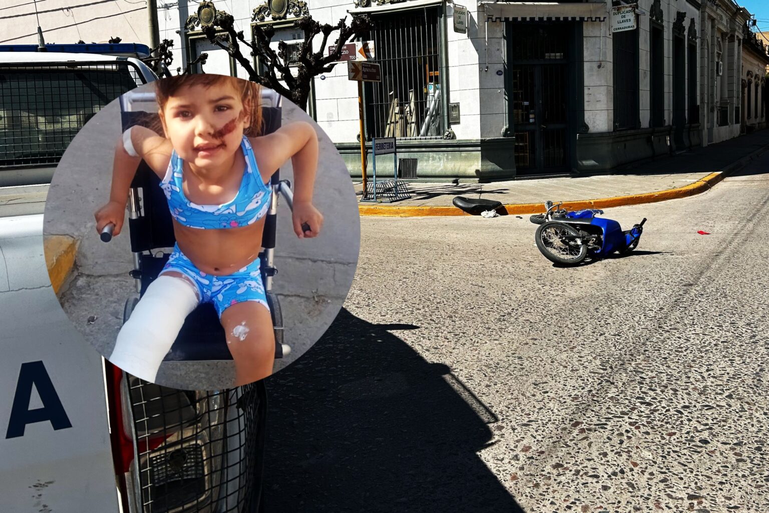IOMA central intervino para que la familia de la niña accidentada no tenga que pagar por la cirugía que necesita | FM Avenida