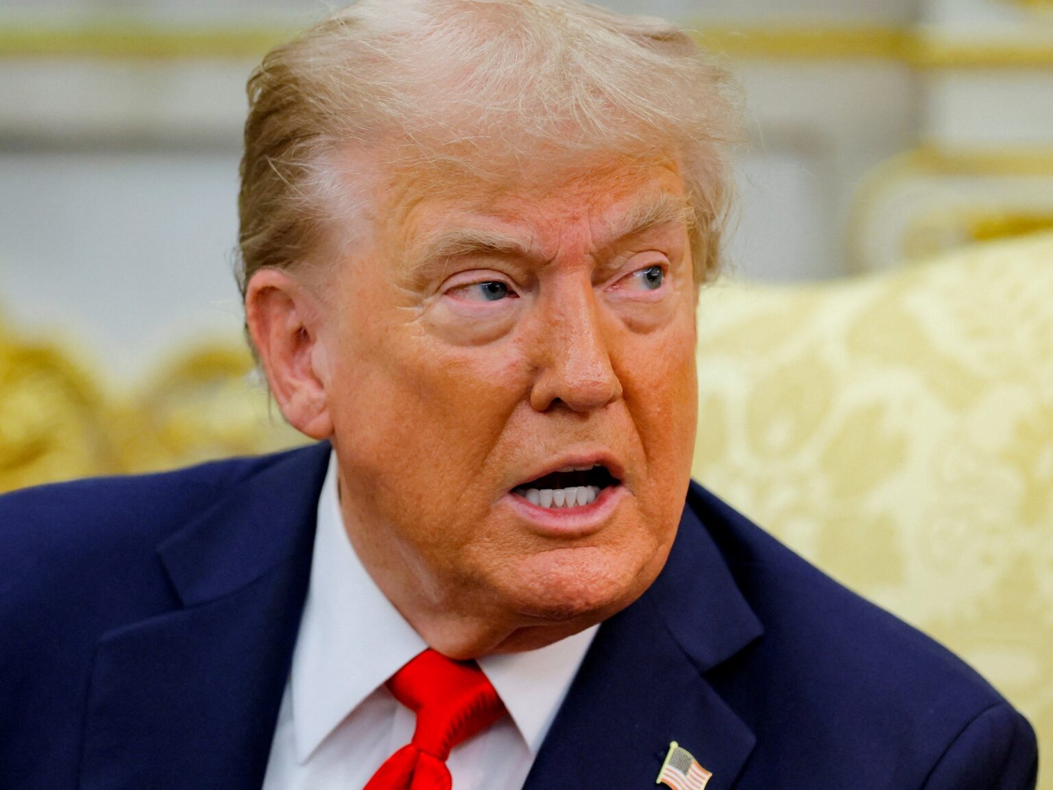 Por qué Donald Trump luce la piel naranja | FM Avenida