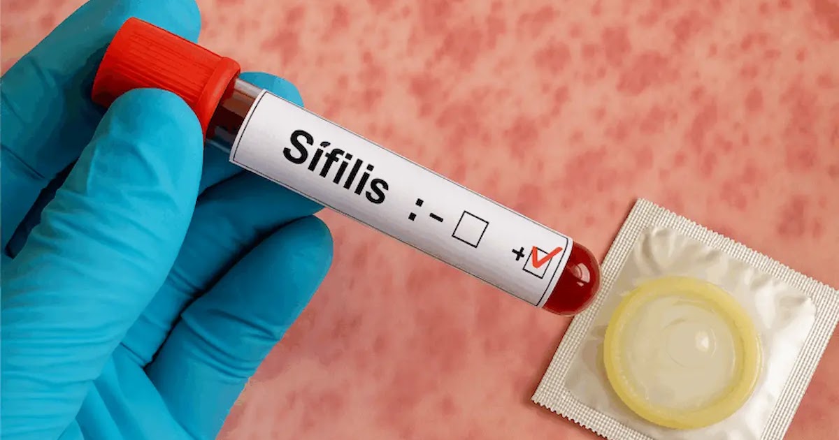 Campaña de detección gratuita de sífilis en Vuelta de Obligado | FM Avenida