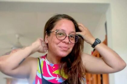 Rifa solidaria para Mayra Corbalán: sufrió un accidente de tránsito y necesita ayuda para el tratamiento médico | FM Avenida