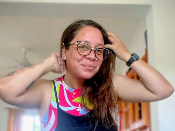 Rifa solidaria para Mayra Corbalán: sufrió un accidente de tránsito y necesita ayuda para el tratamiento médico | FM Avenida