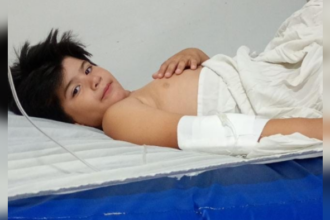 Solidaridad para Milo, el niño herido tras el accidente de Casella y Bottaro | FM Avenida