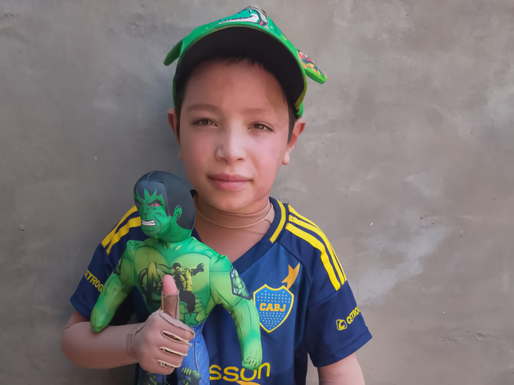 Todos por Noah: el niño necesita ropa especial para continuar su recuperación y su familia pide colaboración | FM Avenida