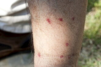 Barigüí: la mosca negra ya llegó al AMBA y las altas temperaturas favorecen su proliferación | FM Avenida