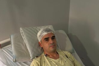 “Estoy vivo de milagro”: Daniel Serra habló tras la brutal agresión que lo dejó con fractura de cráneo | FM Avenida