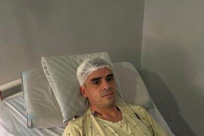 “Estoy vivo de milagro”: Daniel Serra habló tras la brutal agresión que lo dejó con fractura de cráneo | FM Avenida