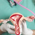 LALCEC San Pedro lanza una campaña de prevención y estudios de PAP por el Mes del Cáncer de Cuello de Útero | FM Avenida