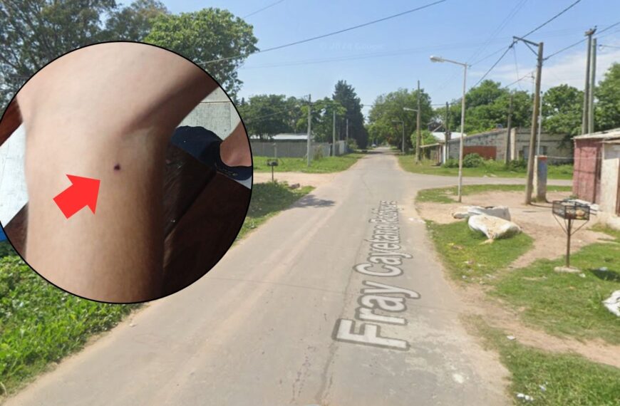 Violencia sin freno: robaron, golpearon y balearon a un niño de 13 años en medio de un conflicto barrial