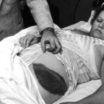 Solo una persona en toda la historia fue golpeada por un meteorito: quién fue y qué le pasó después | FM Avenida