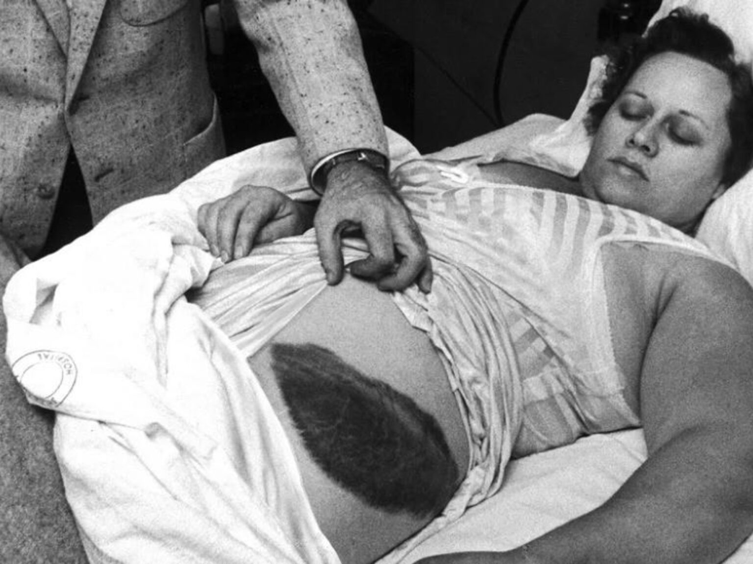 Solo una persona en toda la historia fue golpeada por un meteorito: quién fue y qué le pasó después | FM Avenida