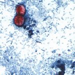 Qué es la Cyclospora, el parásito hallado en la lechuga contaminada que provoca diarrea y otros síntomas | FM Avenida